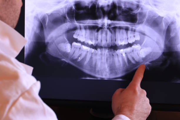 Best Dental Abscess Treatment in Herington, KS